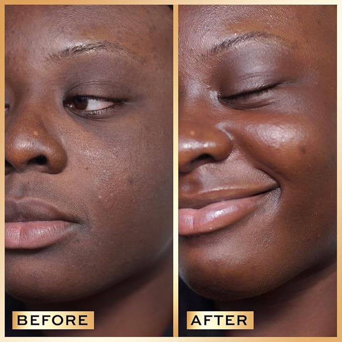 Revolution Pro Miracle Serum, Hydrating Face Serum, Helps Dullness & Uneven Skin Tone with Hyaluronic Acid & Niacinamide, 1 oz