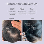 Jupiter Anti-Dandruff Shampoo, Conditioner, & Serum Advanced Set, - Image 3