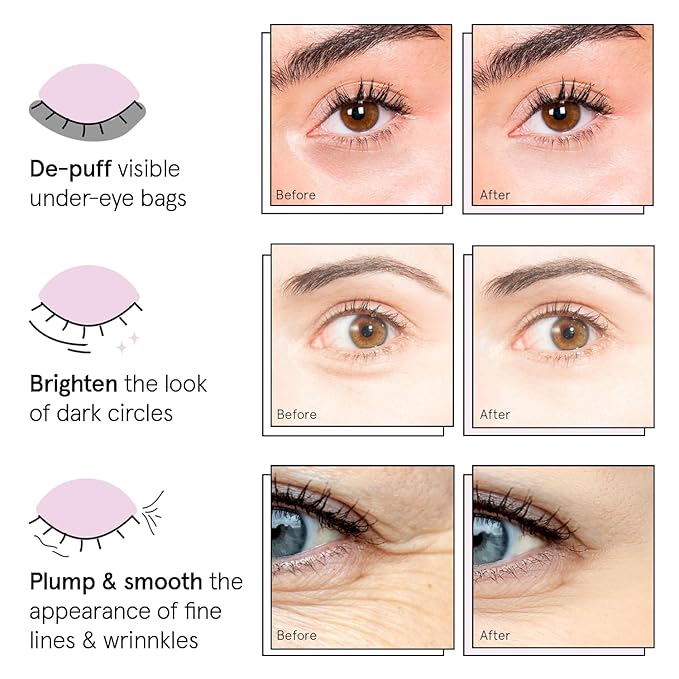 grace & stella Under Eye Patches Eye Masks - Image 3