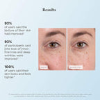 Beverly Hills MD Deep Wrinkle Filler- Decrease Appearance of Deep Wrinkles on Contact, Anti-Aging Serum for Smooth, Lifted Complexion- Helps Correct Fine Lines & Creases w/Diamond Dust & Polymers