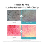medicube Facial Cleanser Azelaic Acid Capsule Foam Cleanser | Soothing Daily Cleansing Foam For Troubled Skin & Excess Sebum Control | Uneven Skin with Niacinamide, Glycerin | Korean Skincare, 4.23 oz