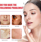 Melanina Anti-Melasma & Dark Kit, Anti-Melasma Serum+Collagen Jelly Cream, Ultra Moisturizer for Women, Supports Even Skin Tone & Radiance (SET)