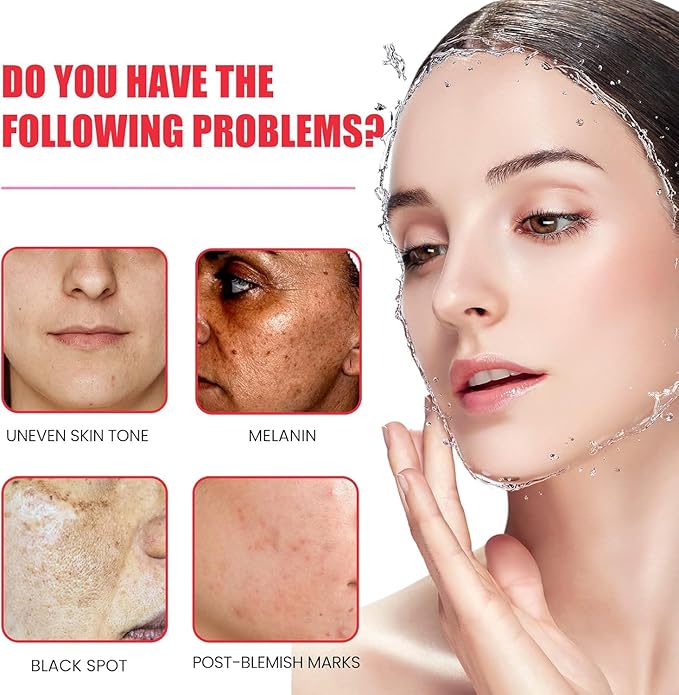 Melanina Anti-Melasma & Dark Kit, Anti-Melasma Serum+Collagen Jelly Cream, Ultra Moisturizer for Women, Supports Even Skin Tone & Radiance (SET)