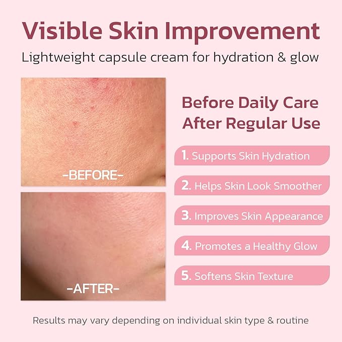 PDRN Pink Collagen Capsule Cream – Salmon PDRN - Dual Texture Barrier Repair Moisturizer | Salmon DNA + 5% Niacinamide 2oz