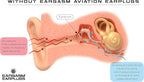 Eargasm Aviation Earplugs Small - Image 6