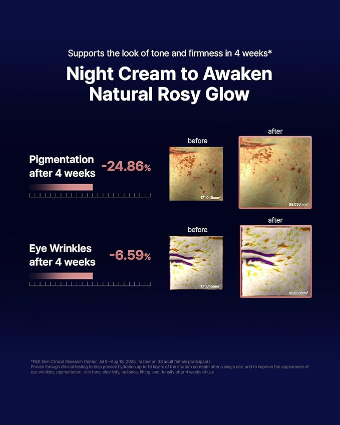 ASCE+ Exo Balm SR2 Night Cream – Skin Rejuvenating Night Cream, Boost Collagen production, Elasticity – 3 Week overnight Wrinkle & Pigmentation Care – 3.38 oz