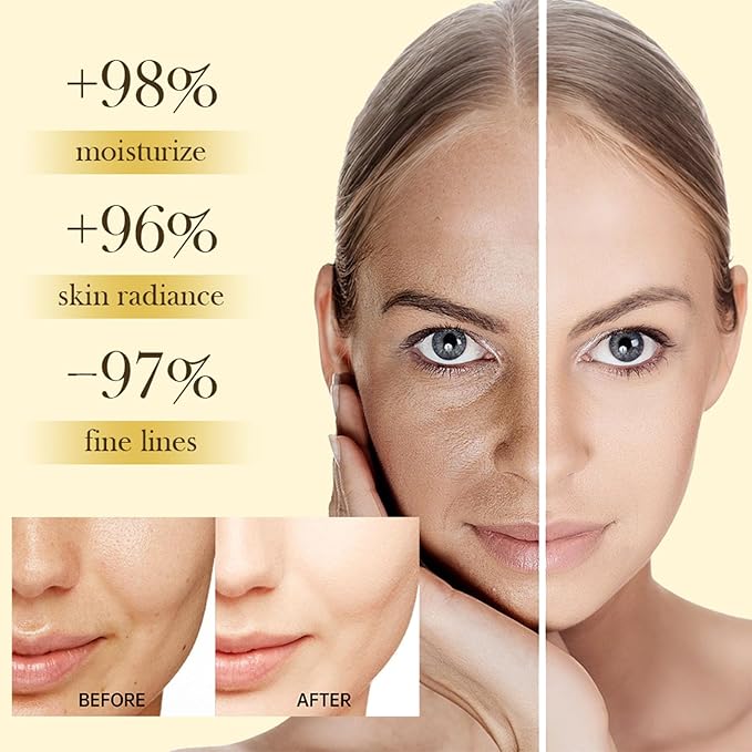 Deep Vita C Capsule Cream, Deep Vitamin C Golden Capsule Face Moisturizer, Antioxidant Protection, Reduce Wrinkles & Fine Lines, Firming Skin, Deeply Moisturizing Skin, Shrink Pores, 4.9 OZ