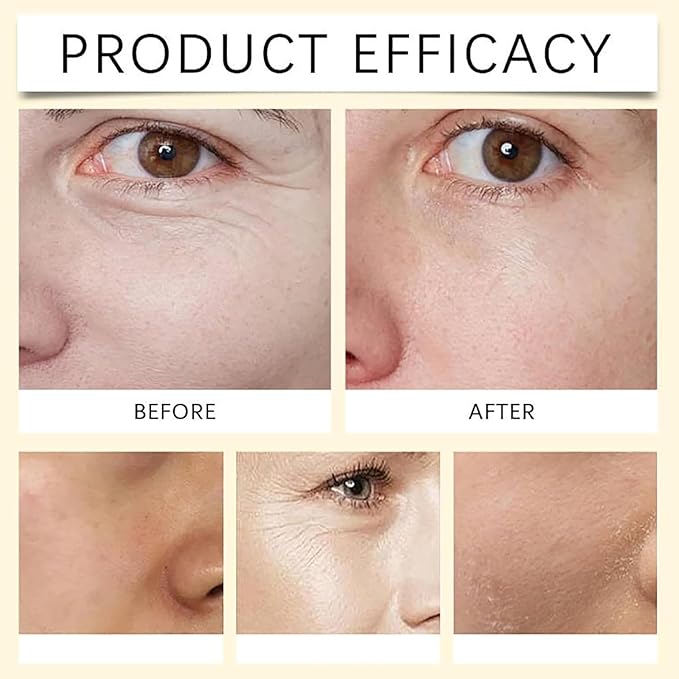 Polypeptide Collagen Elastic Essence Cream, Micro-Molecular Collagen Anti-Wrinkle Lotio, Skin Firming Cream, Oisturizing Skin