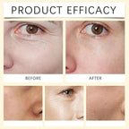 Polypeptide Collagen Elastic Essence Cream, Micro-Molecular Collagen Anti-Wrinkle Lotio, Skin Firming Cream, Oisturizing Skin