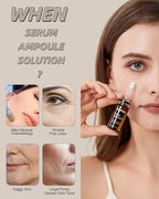 Anti Aging Serum with Hyaluronic Acid for Microneedling Serum Ampoules for Face 0.35 oz 4 Vials