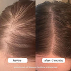 BONDIBOOST HG Anti-Thinning Shampoo - Image 4