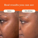 Live Tinted Superhue Hyperpigmentation Serum Stick Mini - Balm-to-Serum Stick For Face & Body - Skin Care with Niacinamide & Vitamin C, Facial Serum Stick for Dark Spots, 0.23 oz