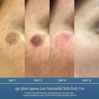 Admire My Skin Dark Spot Corrector Remover for Face - Brightening Discoloration Correcting Serum - Kojic Acid + Azelaic Acid Serum for Melasma and Sun Spots 1oz