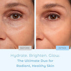 Cosmedica Skincare Set- Vitamin C Super Serum and Pure Hyaluronic Acid