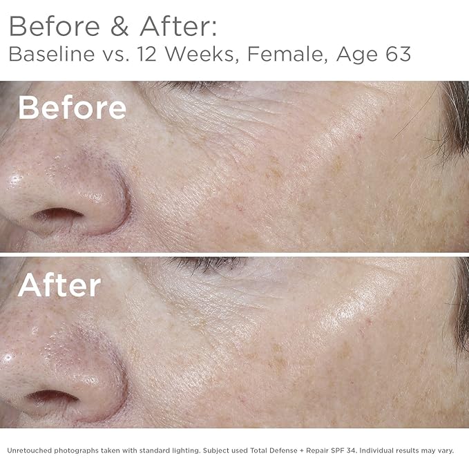 SkinMedica Total Defense + Repair SPF 34 Sunscreen for Face. This Lightweight, Facial Sunscreen is Ideal for Oily and/or Combination Skin, 2.3 Oz
