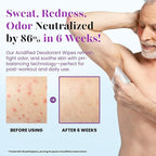 Zero Trace Travel Deodorant Wipes - Image 5