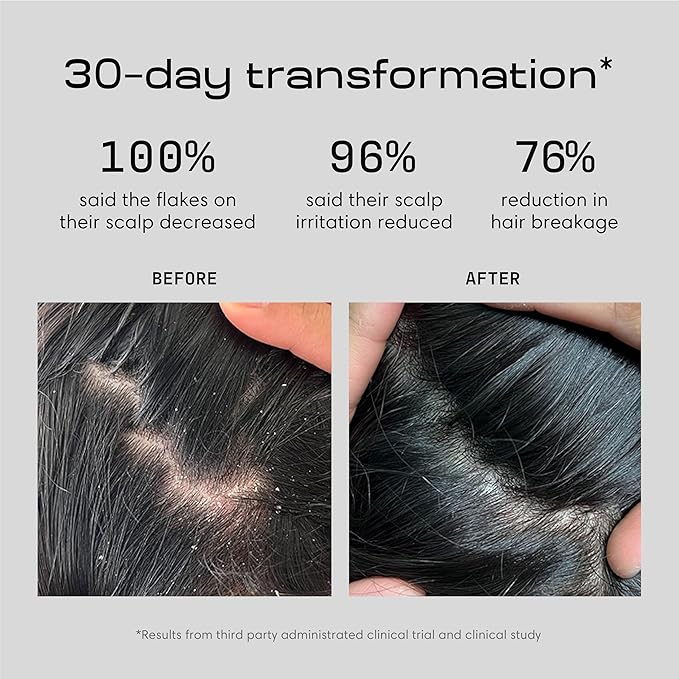 Jupiter Balancing Anti Dandruff Shampoo Duo, - Image 3