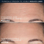 RoC Hydration+ Replumping Serum Stick, Fragrance-Free, Hydrating And Cooling Hyaluronic & Peptide Formula To Boost Elasticity And Visibly Smooth Aging Skin, With Line Smooth Eye Cream Packette, 0.7oz