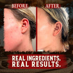 Organic Beef Tallow for Skin - 4 OZ (Citrus) — Grass Fed Beef Tallow for face + Body — US-Made Whipped Tallow and Honey Balm Moisturizer for Dry and Sensitive Skin, Eczema, Rosacea (No Additives)