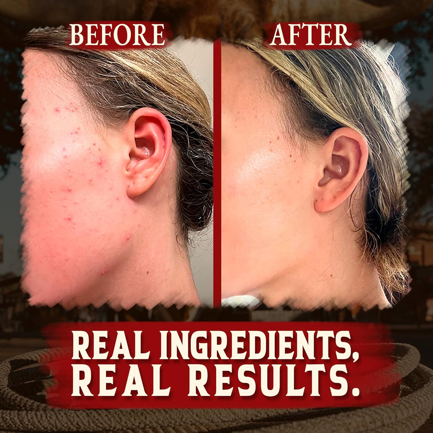 Organic Beef Tallow for Skin - 4 OZ (Citrus) — Grass Fed Beef Tallow for face + Body — US-Made Whipped Tallow and Honey Balm Moisturizer for Dry and Sensitive Skin, Eczema, Rosacea (No Additives)