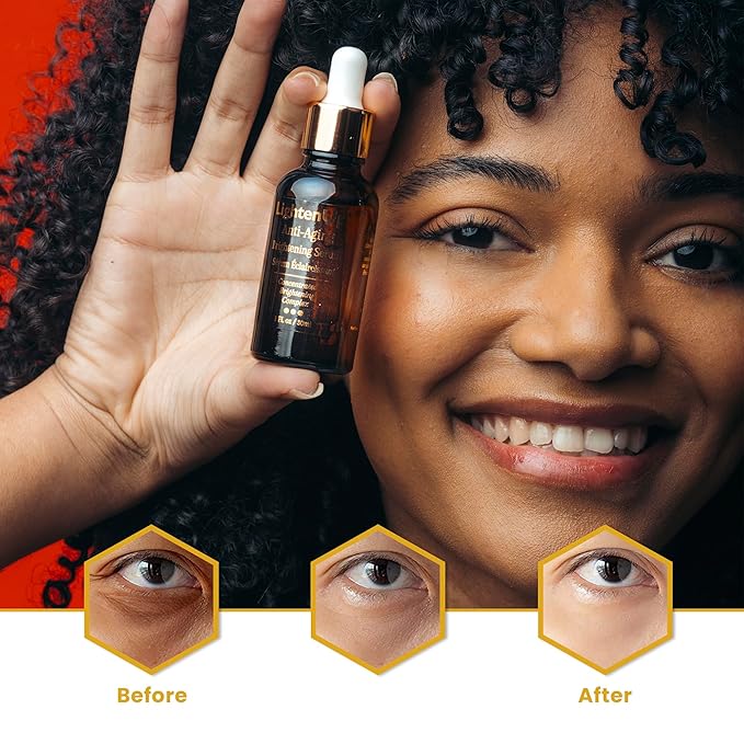 Lighten-Up Skin brightening Serum, 1 Fl oz / 30 ml, for Face, Armpits, Hands, Knees and Body, with Argan Oil and Shea Butter