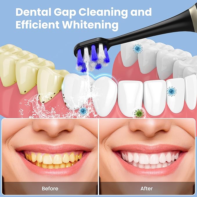 Portable Water flosser with Electric Toothbrush, 2 in 1 Teeth Cleaning Kit - Image 2